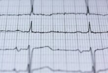 hyper pulse fusion node